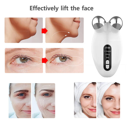 SkinTone Lift: Advanced EMS Face Rejuvenation Tool